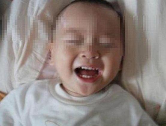 孩子不小心摔倒碰到后脑勺怎么办孩子不小心摔倒碰到后脑勺怎么办？家长应对策略与注意事项