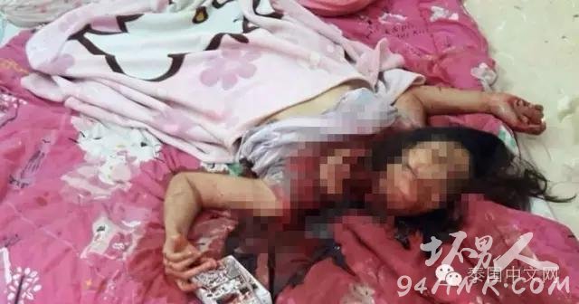 女子在泰被沉尸胸部假体印中文