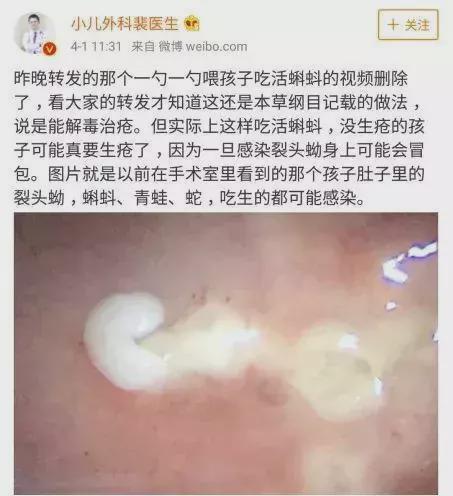 女童呕吐活虫一个月，背后的真相与健康警示